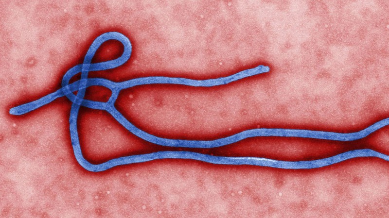 2048px-ebola_virus_virion